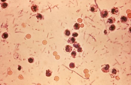 La Shigella, il batterio responsabile della dissenteria bacillare